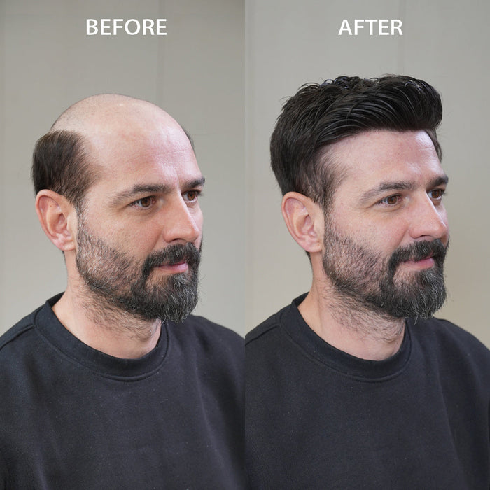 Are Hair Systems Noticeable? Here’s the Honest Truth