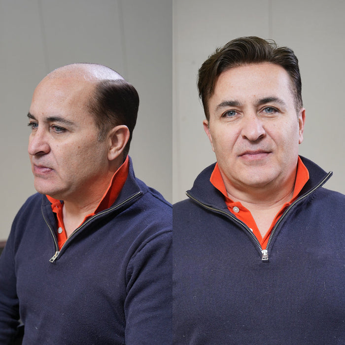 Affordable human hair pieces: why Lyrical Hair is a practical choice for men's hair systems