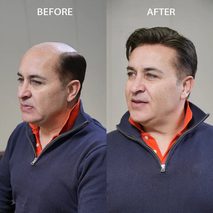 Can You Swim, Workout & Travel With a Men’s Hairpiece? All Scientific Answers Inside