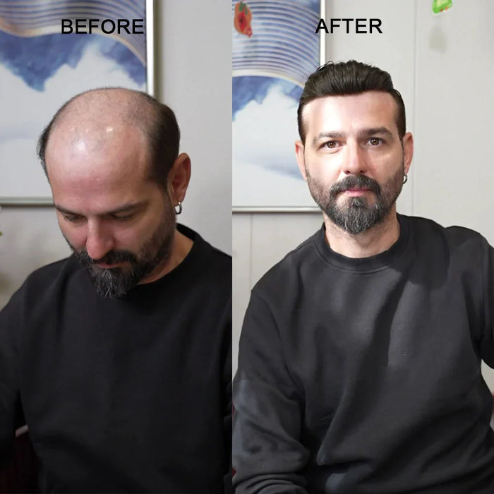 mens toupee