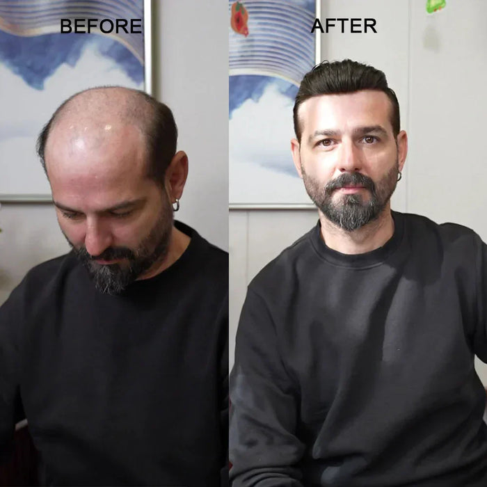 Will Tape & Glue Damage Your Scalp? Safe Wearing Science for Sensitive Skin Men