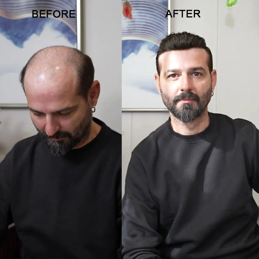 mens toupee