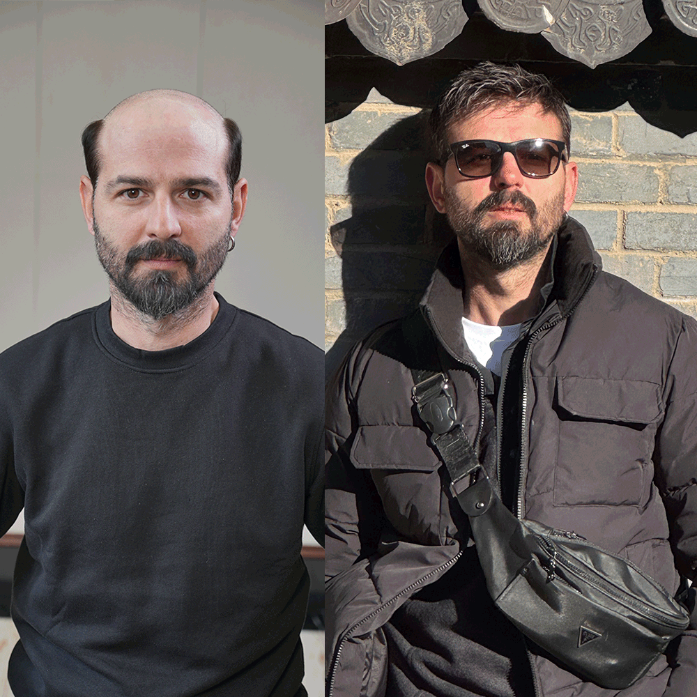 Lyrical Hair Men Toupee — Best Choice for Wedding and Formal Events