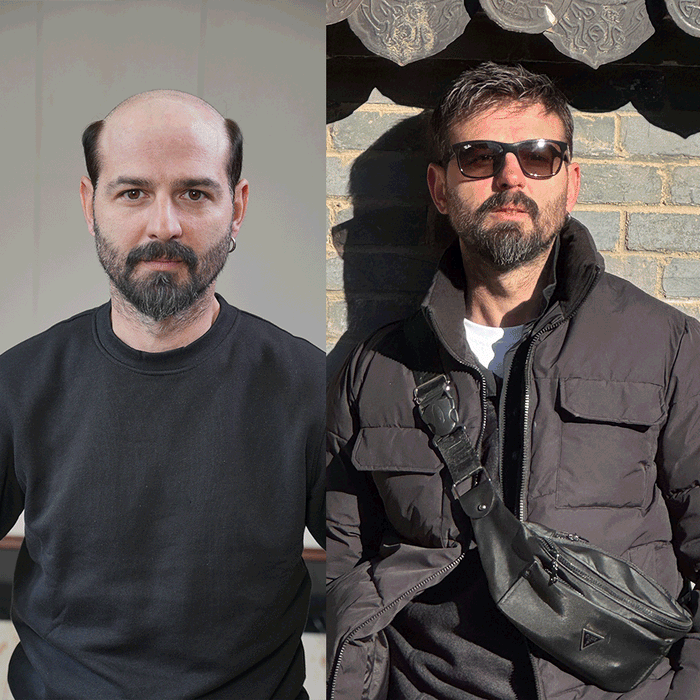 Lyrical Hair Men Toupee — Best Choice for Wedding and Formal Events