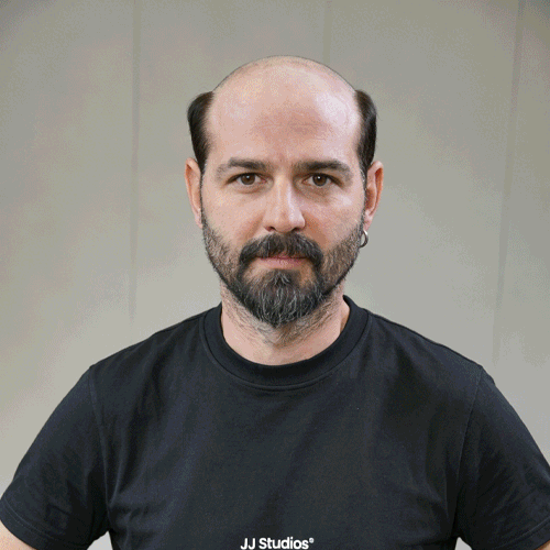 Lyrical Hair Men Toupee — Ideal for Fathers and Middle-Aged Men