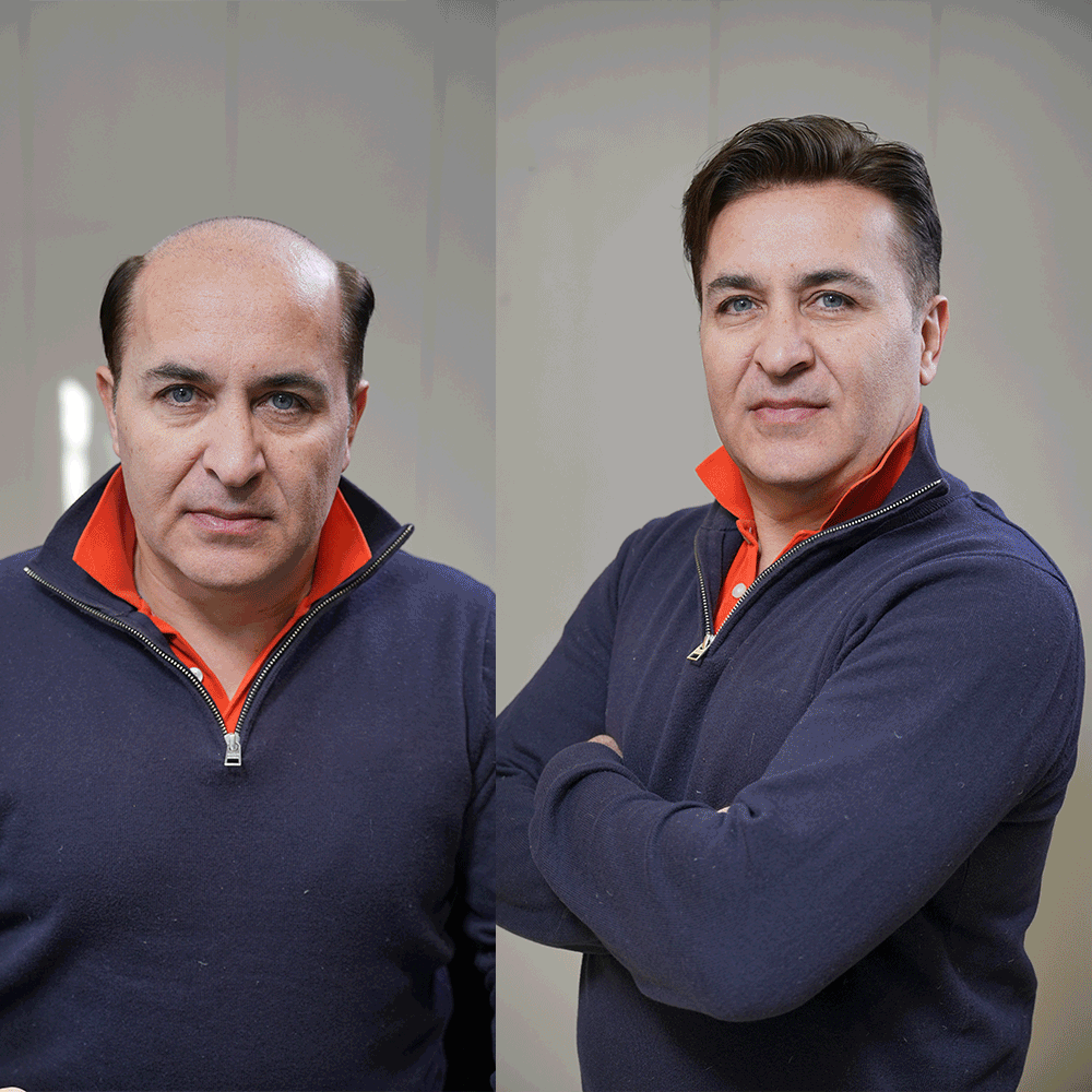 Lyrical Hair Men Toupee — Safe and Reliable for Sports and Fitness