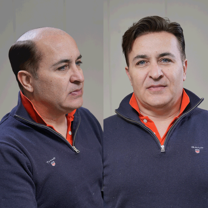 mens toupee
