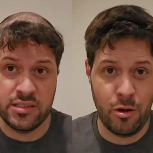 Discover Confidence with Lyrical Hair: Premium Hair Systems for Men