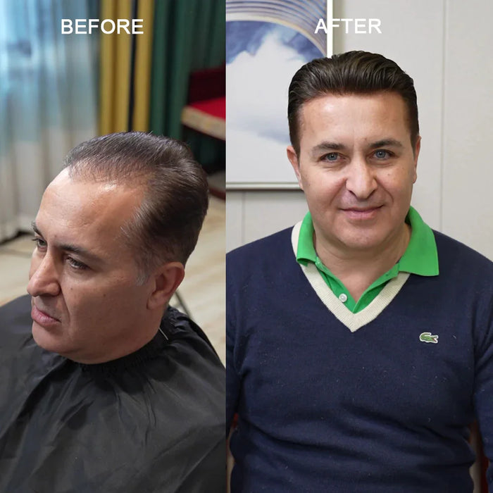 Why Cheap Men’s Hair Piece Ruin Your Confidence—Key Quality Standards Every Buyer Must Know