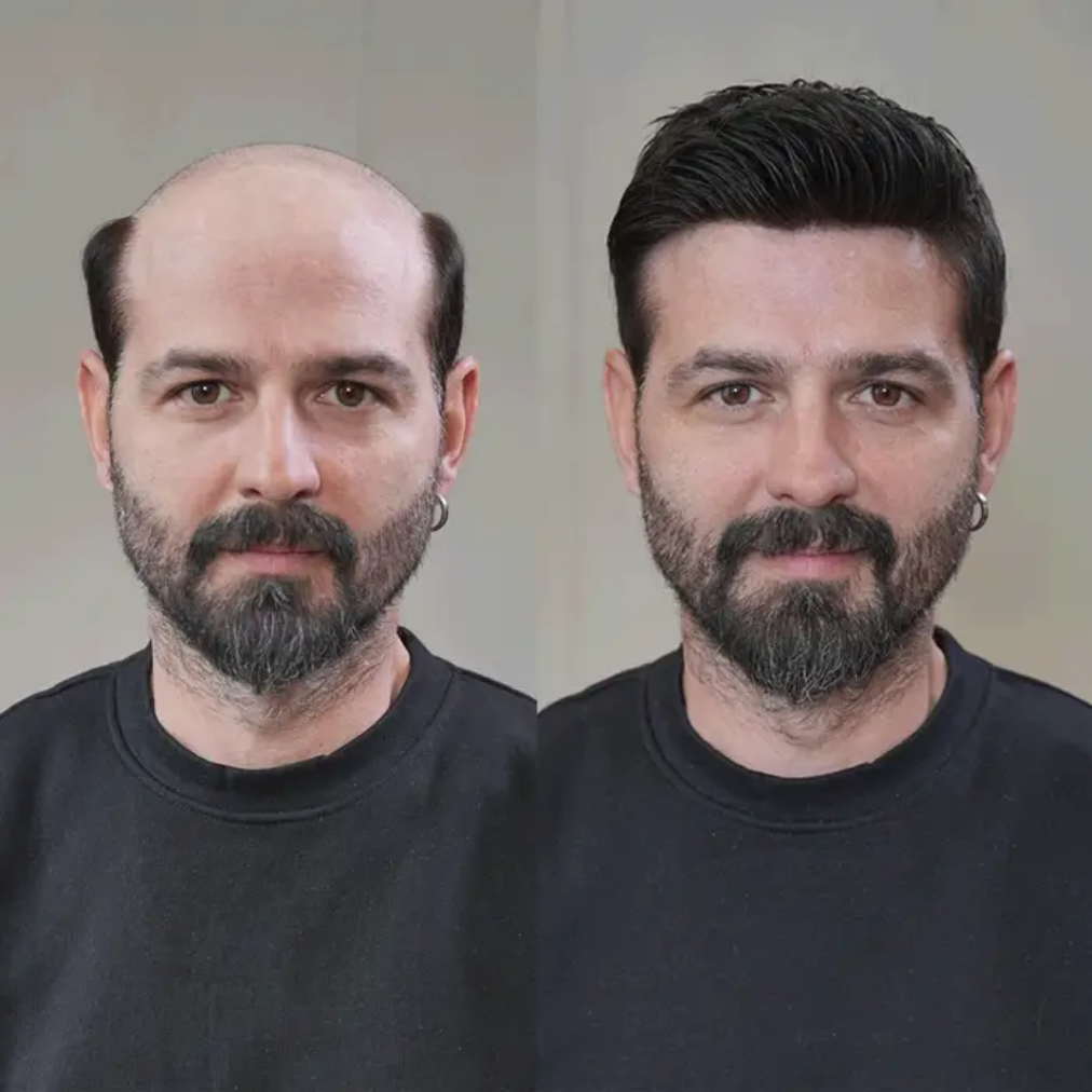11 Terms Every Man Should Know Before Buying Hair Online