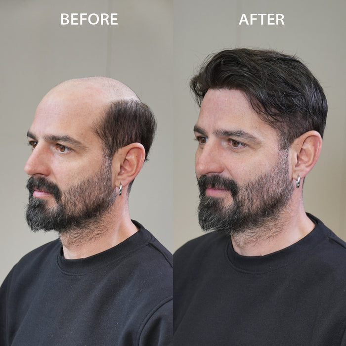 LYRICAL HAIR Human Hairpiece French Lace Mens Toupee Poly Skin Around Mens Hair System