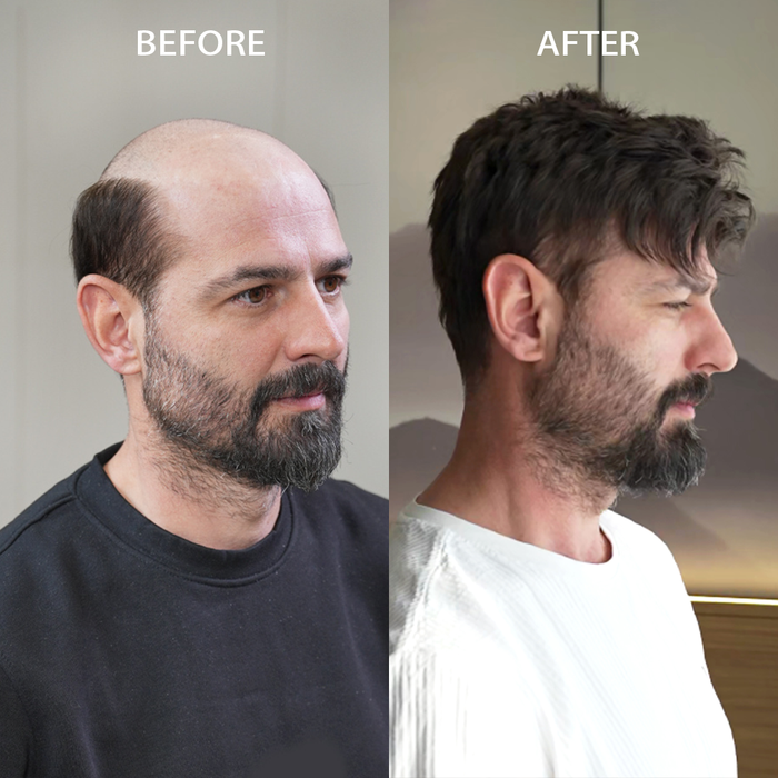 LYRICAL HAIR US Stock French Lace With Poly Coated Human Hair System For Men Natural Hairline Bleached  Knots Invisible Knots Toupee for Men  | Black