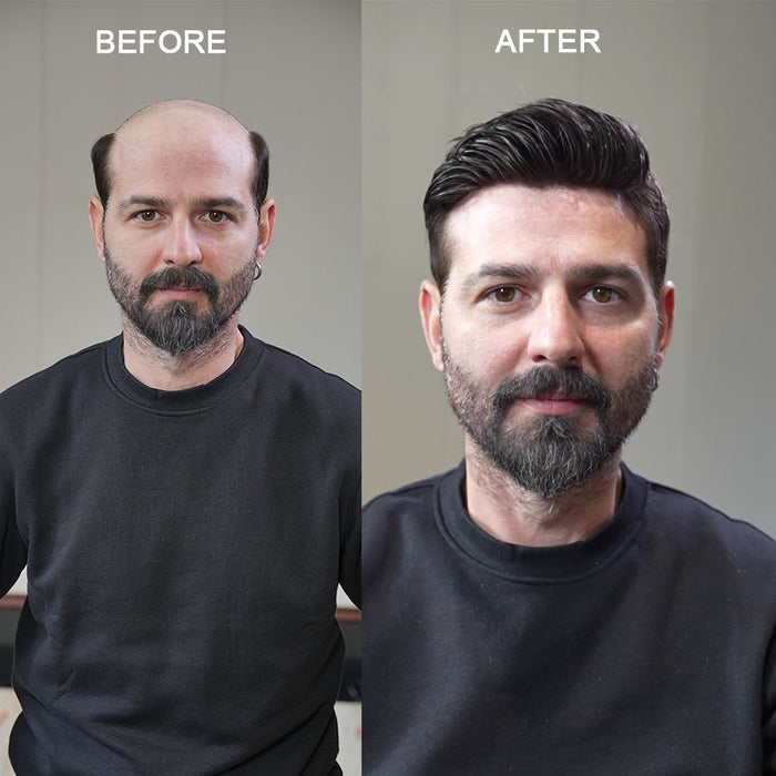 LYRICAL HAIR Human Hair System For Men Fine Monofilament With PU Hairpieces For Men