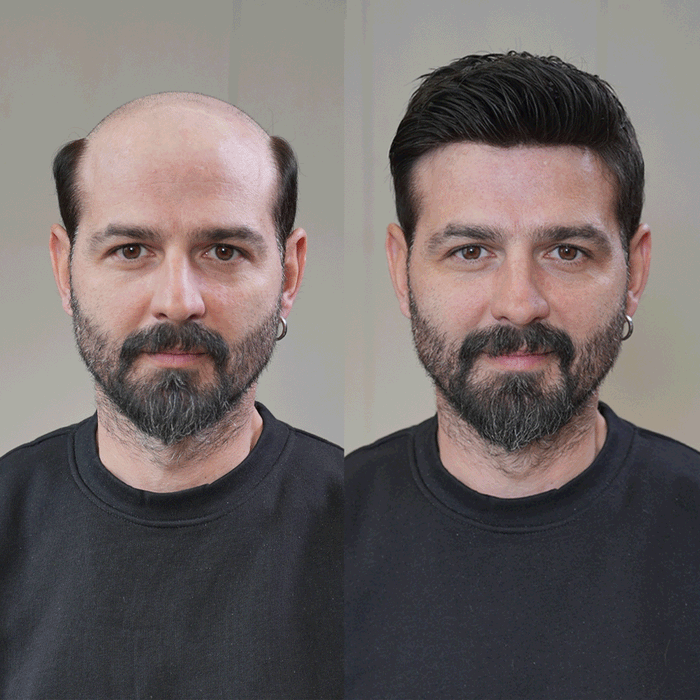 LYRICAL HAIR Mens Toupee 0.06mm Ultra Thin Skin Hair Replacement System for Men V-Looped Knots Mens Hairpieces Natural Hairline Toupee for Men