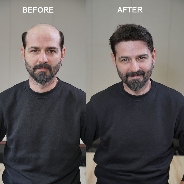 LYRICAL HAIR Mens Toupee 0.06mm Ultra Thin Skin Hair Replacement System for Men V-Looped Knots Mens Hairpieces Natural Hairline Toupee for Men |Brown